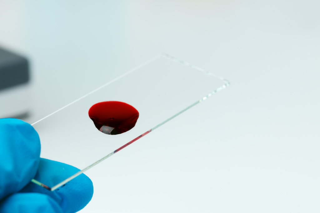 laboratory-glass-slide-with-drop-blood-close-up.jpg