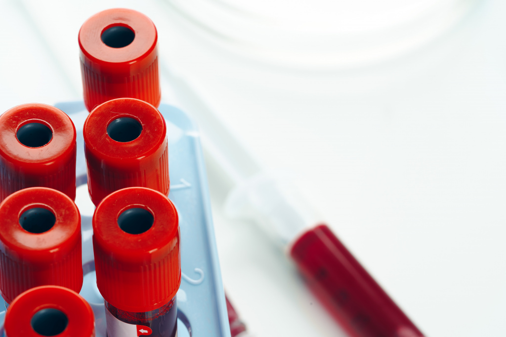 close-up-blood-test-tube-with-blood.jpg close-up-blood-test-tube-with-blood.jpg
