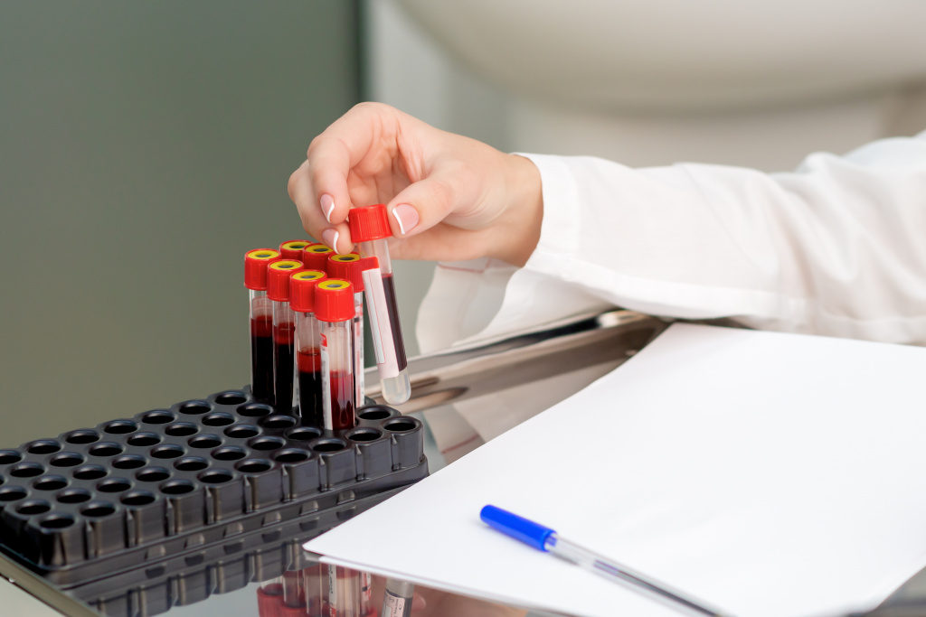 blood-sample-tubes-hands.jpg