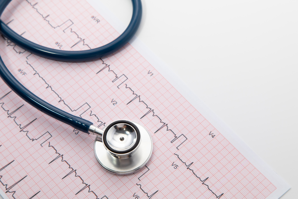blue-stethoscope-electrocardiogram-ecg-chart-paper-ecg-heart-chart-scan-isolate-white-healthcare-insurance-medical-background.jpg blue-stethoscope-electrocardiogram-ecg-chart-paper-ecg-heart-chart-scan-isolate-white-healthcare-insurance-medical-background.jpg